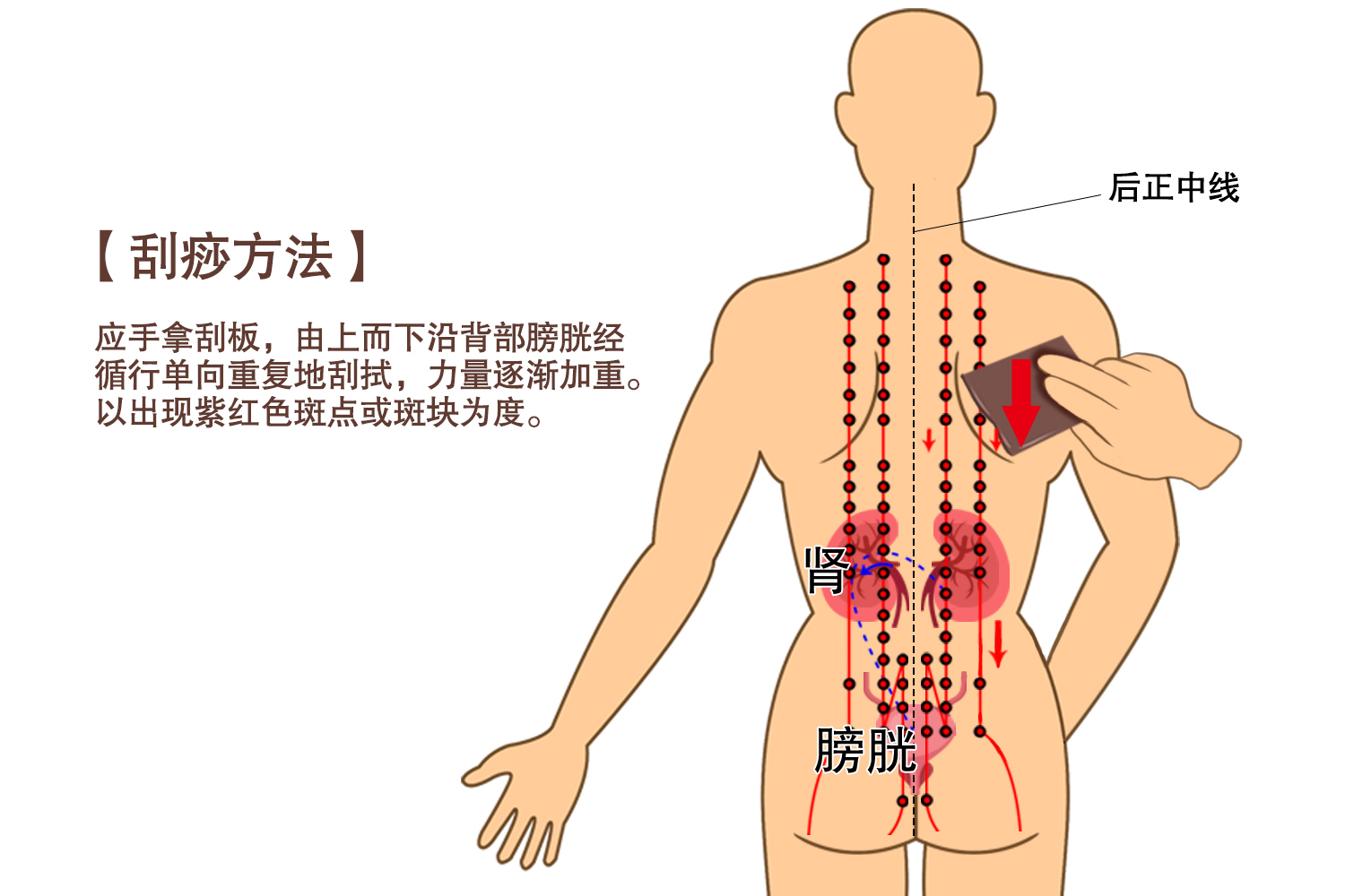 背部刮痧位置示意图图片