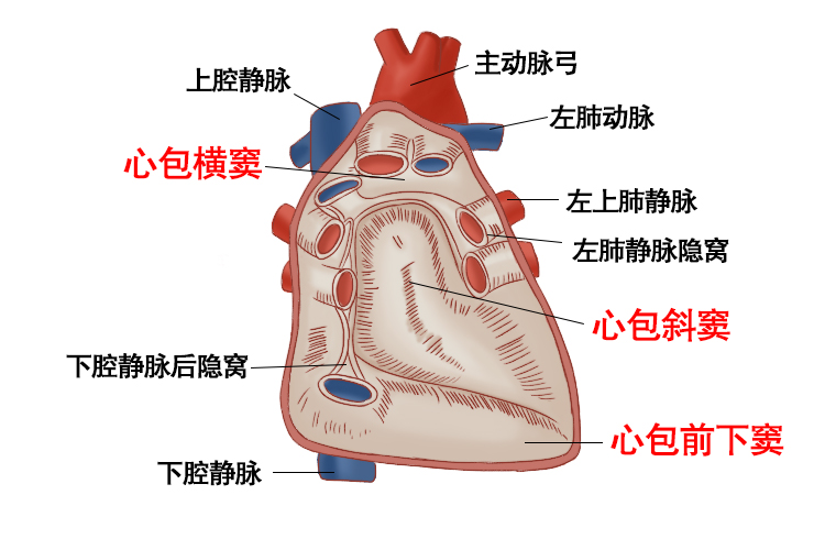 心包窦图