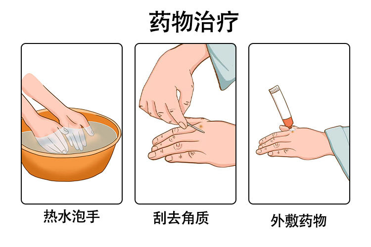 鸡眼图片