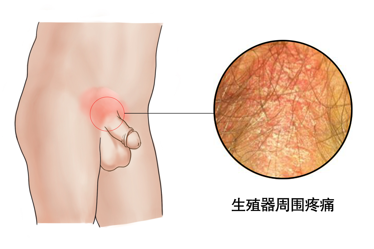 正常龟头皮肤图片