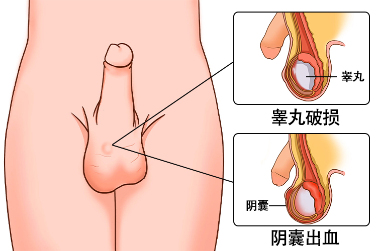外伤图