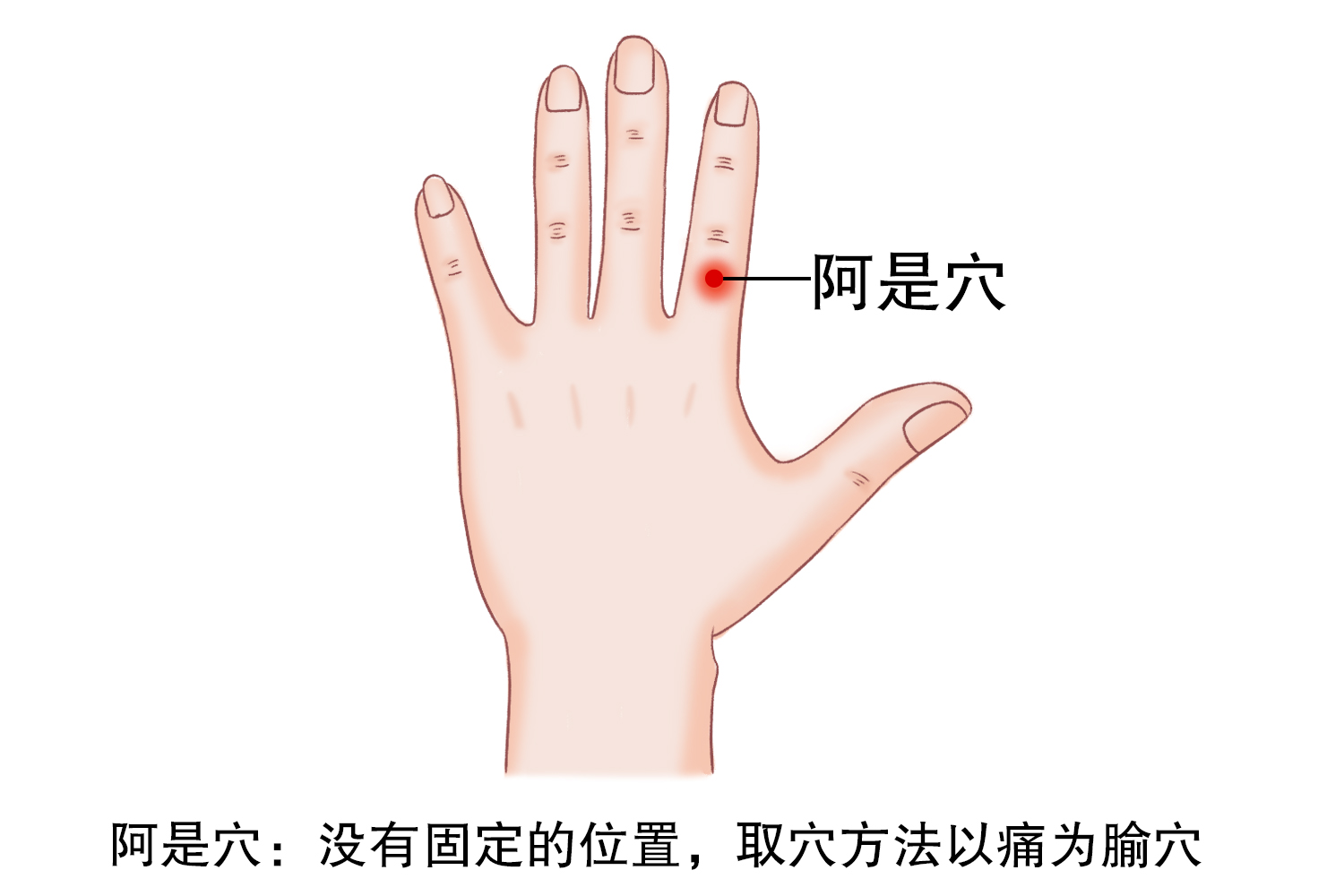 阿是穴图