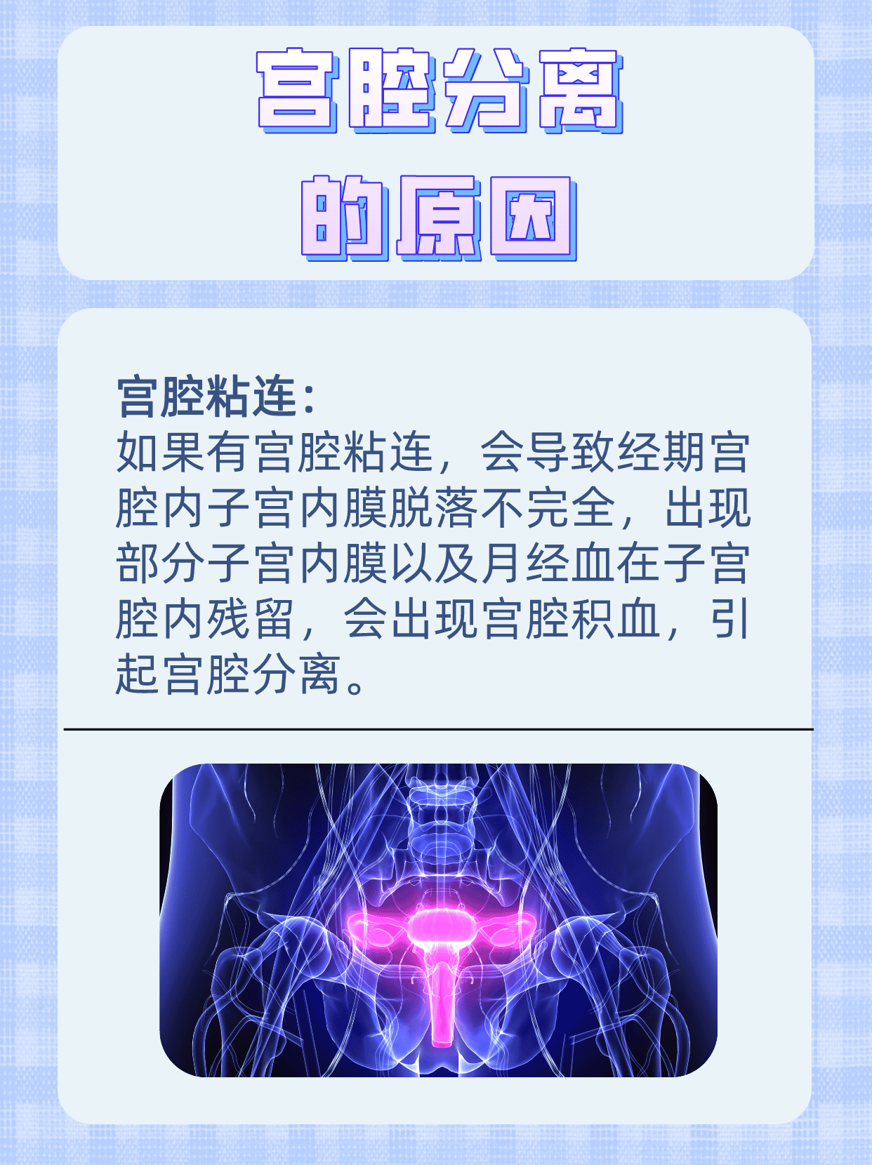 宫腔分离图解图片