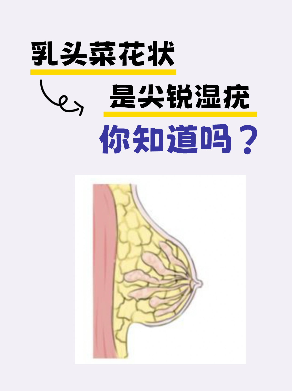 菜花状肉粒是什么原因图片