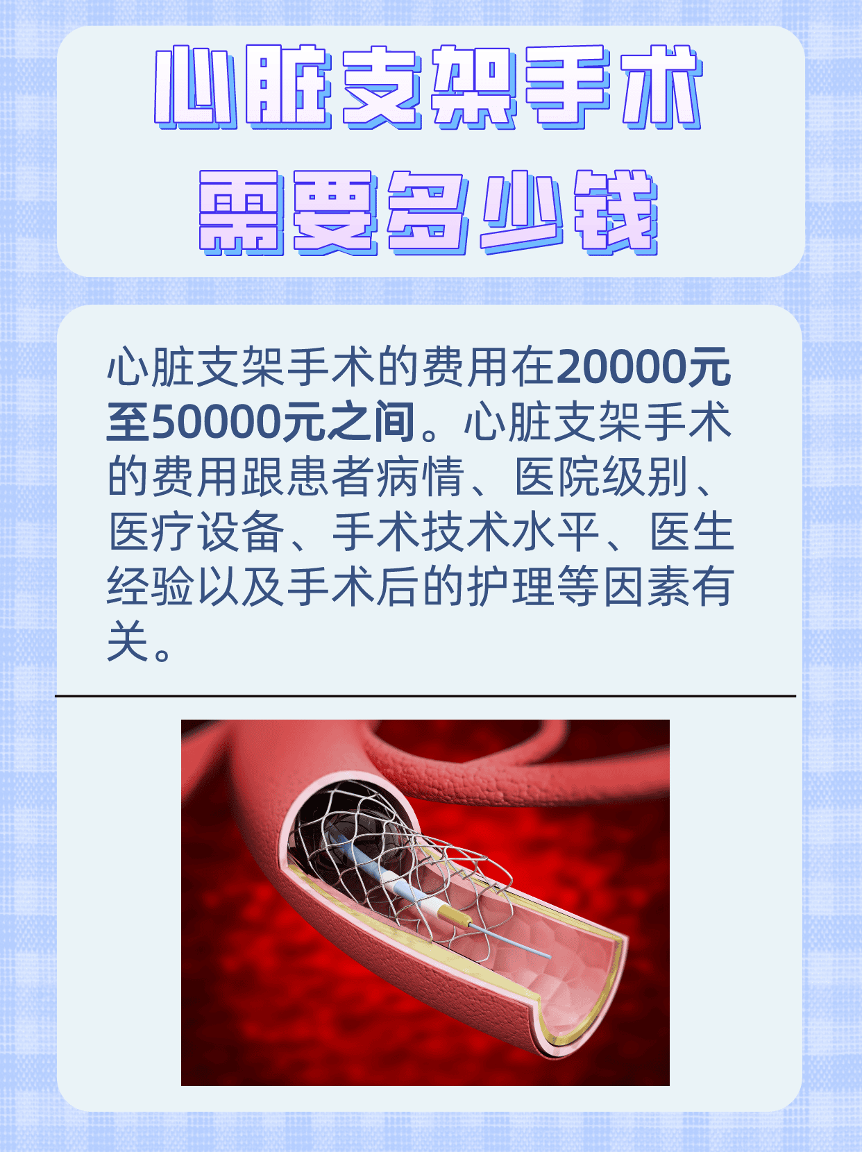 心脏支架多少钱一个图片