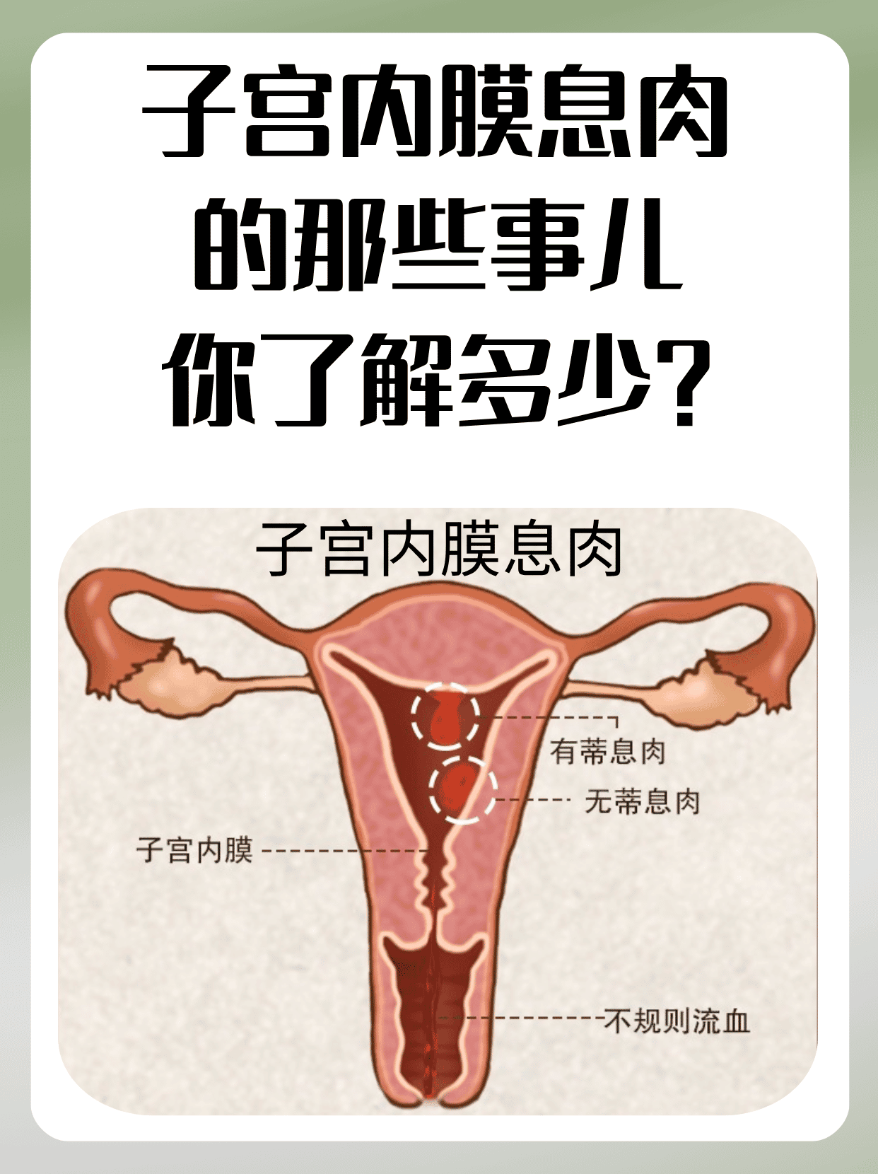 子宫内膜息肉标本图片